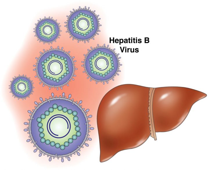Panduan diagnosis dan tatalaksana hepatitis B terkini